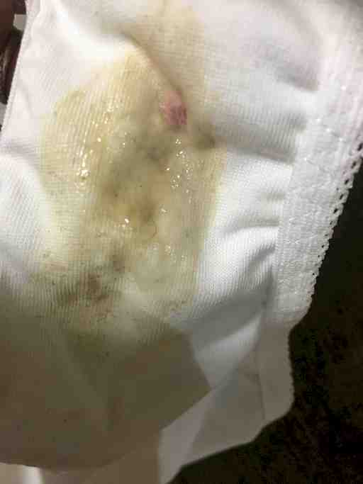 おりもの、陰〇付きBPセット❤