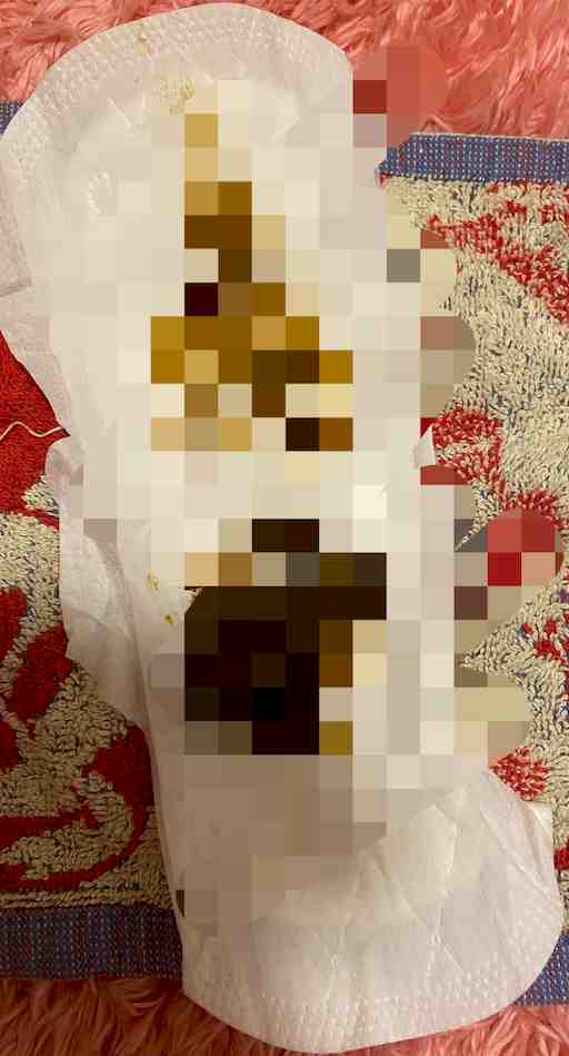 う○ち付きナプキンお漏らし