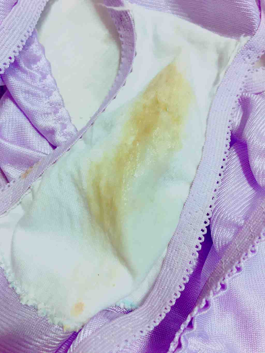 3日半着用済♡うんシミ付き汚パンツ — 商品 — Luscio ラシオ 女子の使用済み下着直販サイト 2283